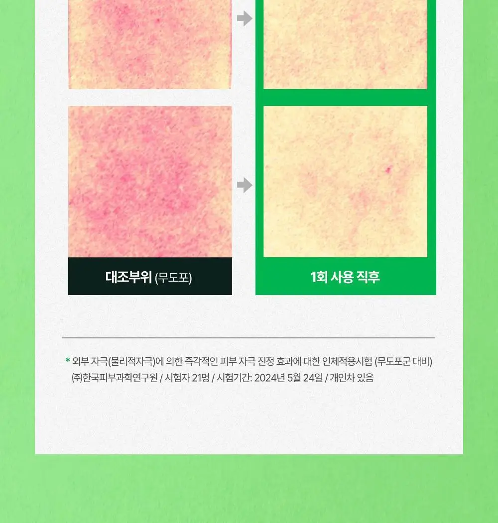 [화잘먹 엑소좀진정크림] 리브엠 시카좀 카밍 워터 젤크림 100ml 상세페이지 24